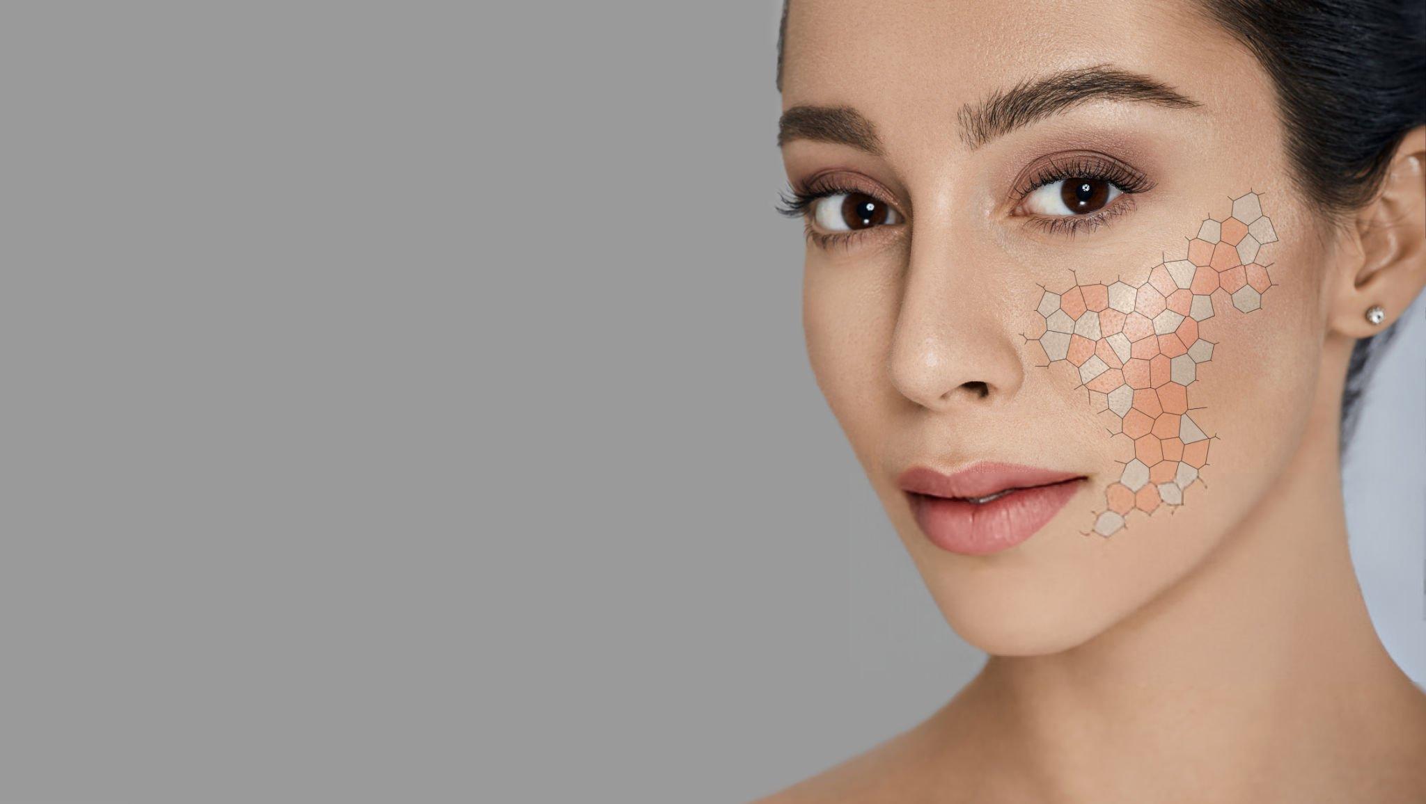 terapia autologa rigenerativa chirurgia e medicina estetica