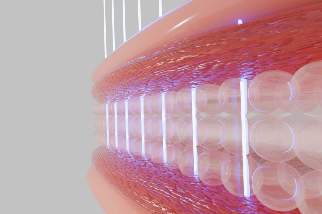 laser co2 frazionato cicatrici