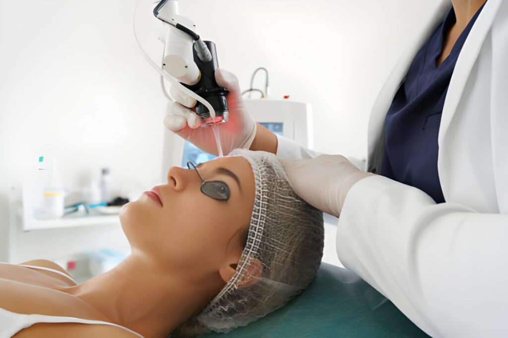 endolift laser