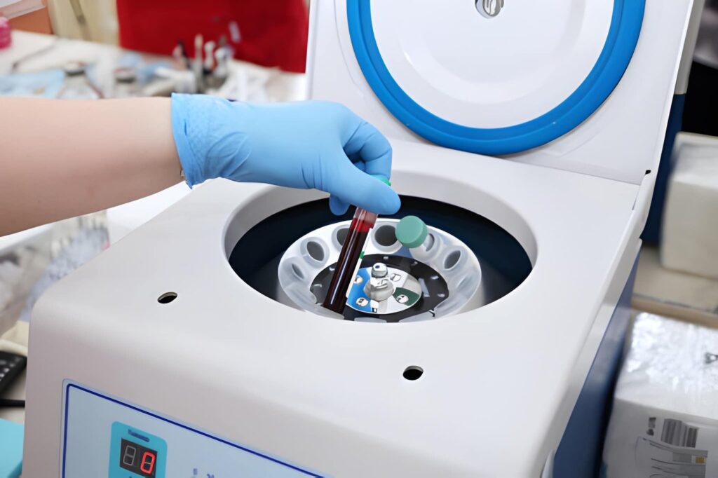 centrifuga prelievo di sangue