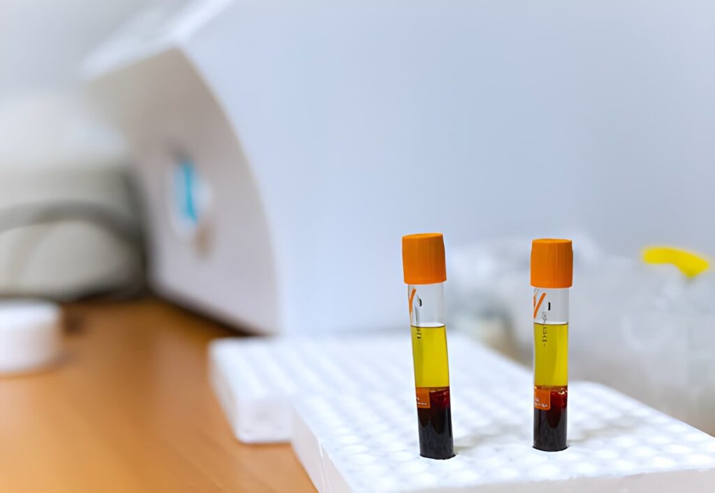 provette per trattamento autologo