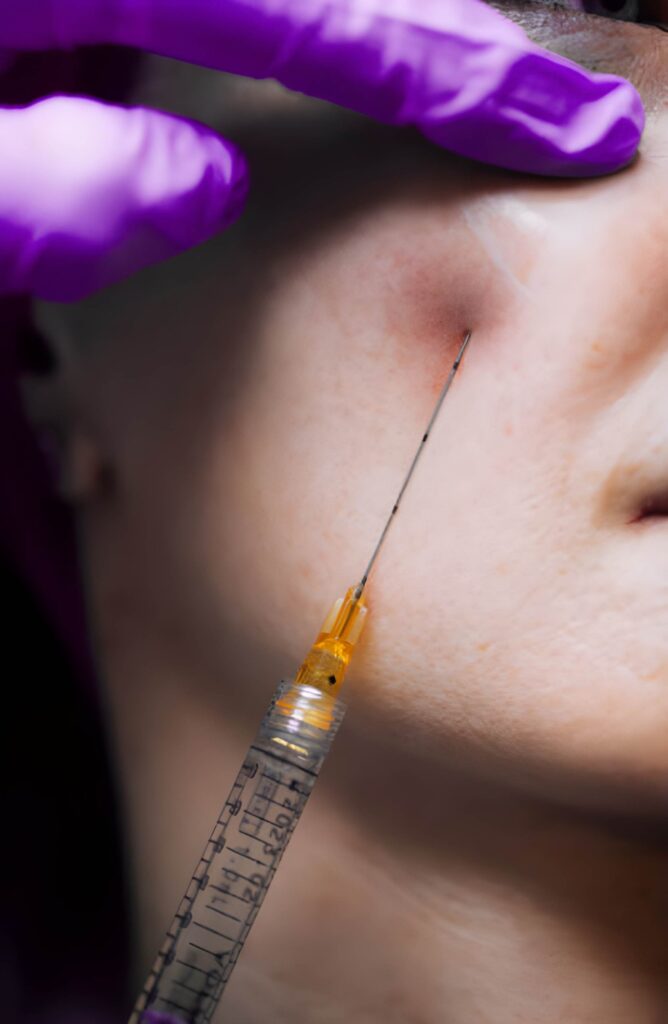 Granuloma Filler