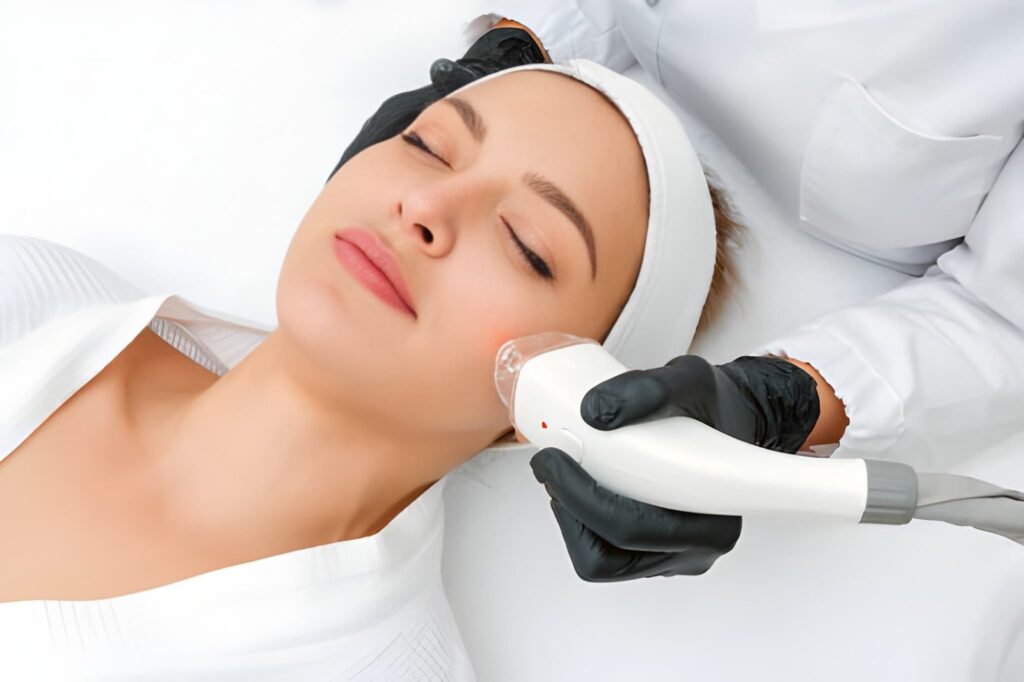 Trattamento laser
