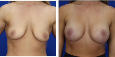 GalaFlex