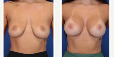 GalaFlex