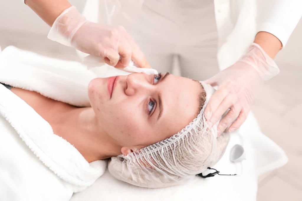 Acne Terapia Fotodinamica